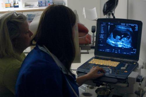 Dokter dan bidan memeriksa janin, apakah berpotensi terkena sindrom down atau tidak.