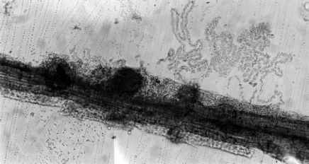 Penyakit bercak daun jahe